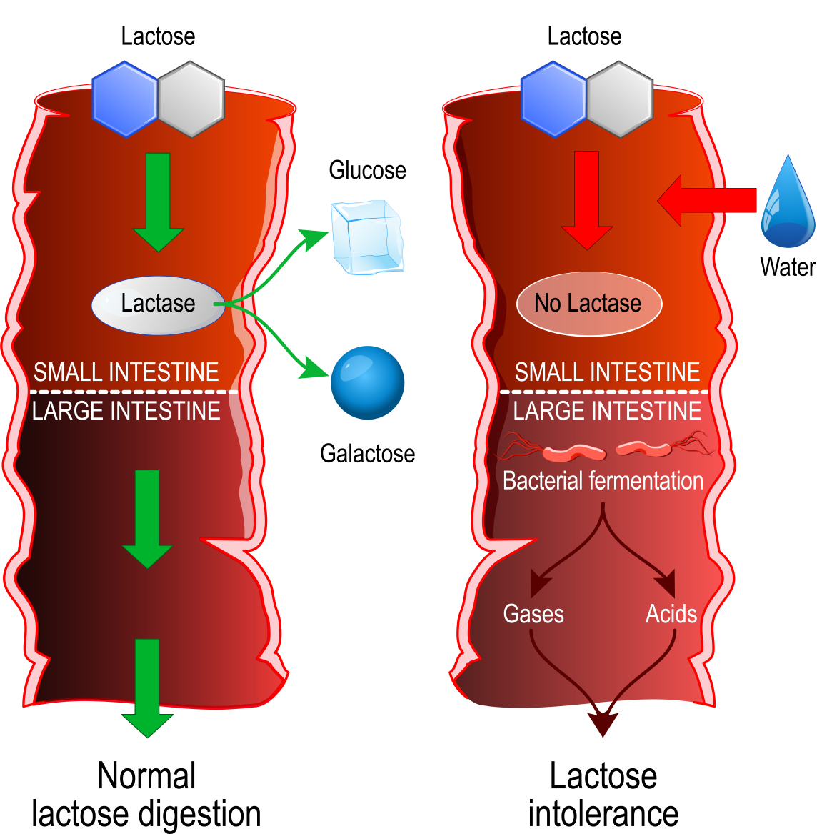 Lactose Intolerance IFANCA