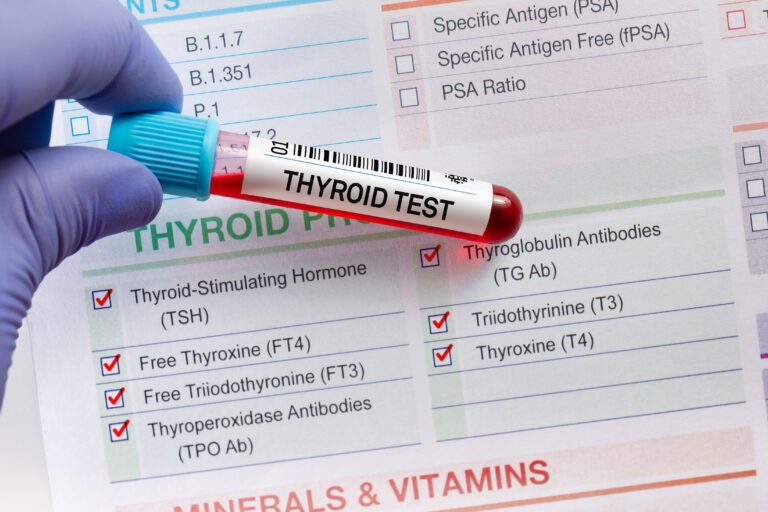 Blood tube test with requisition form for Thyroid gland test. Blood sample tube for analysis of Thyroid tests in laboratory